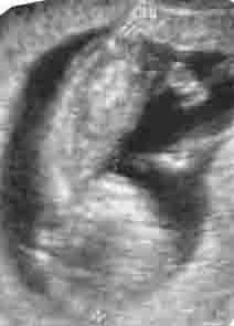 CUESTI&Oacute;N DE FELICIDAD